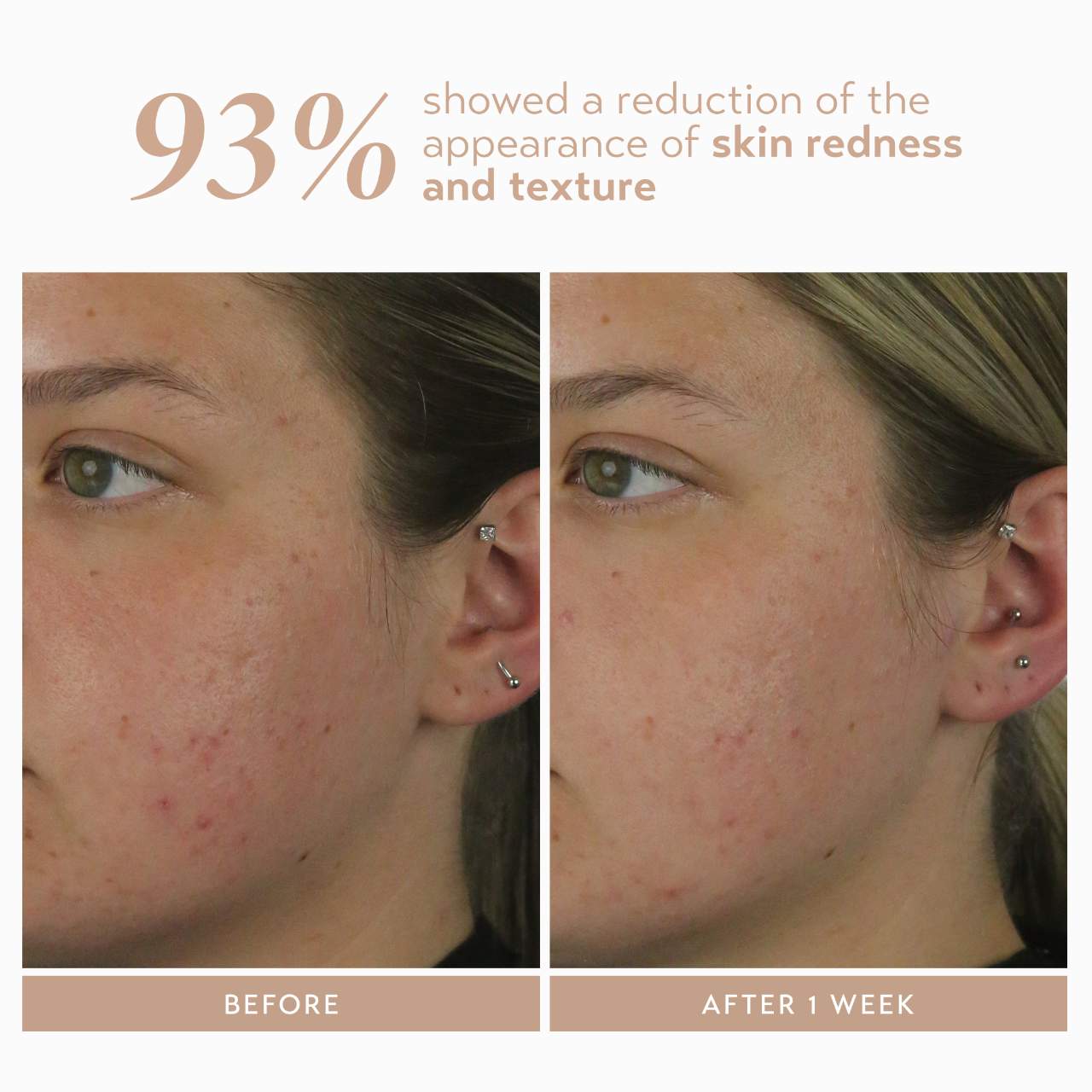 Сыворотка с 10% азелаинового комплекса от пигментных пятен Shani Darden Skin Care Rescue — фото 4