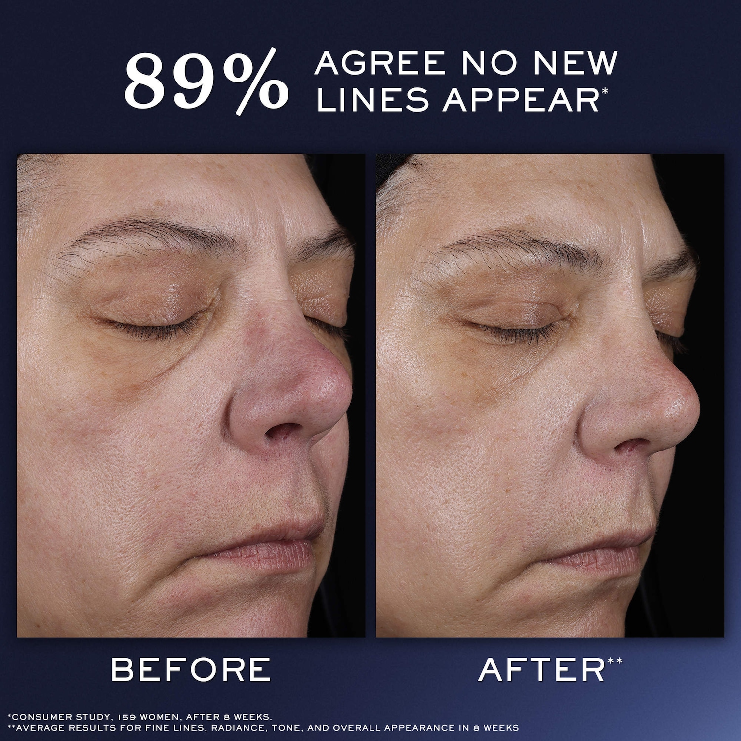 Génifique Ultimate Recovery Serum for Skin Barrier Repair - Lanc&