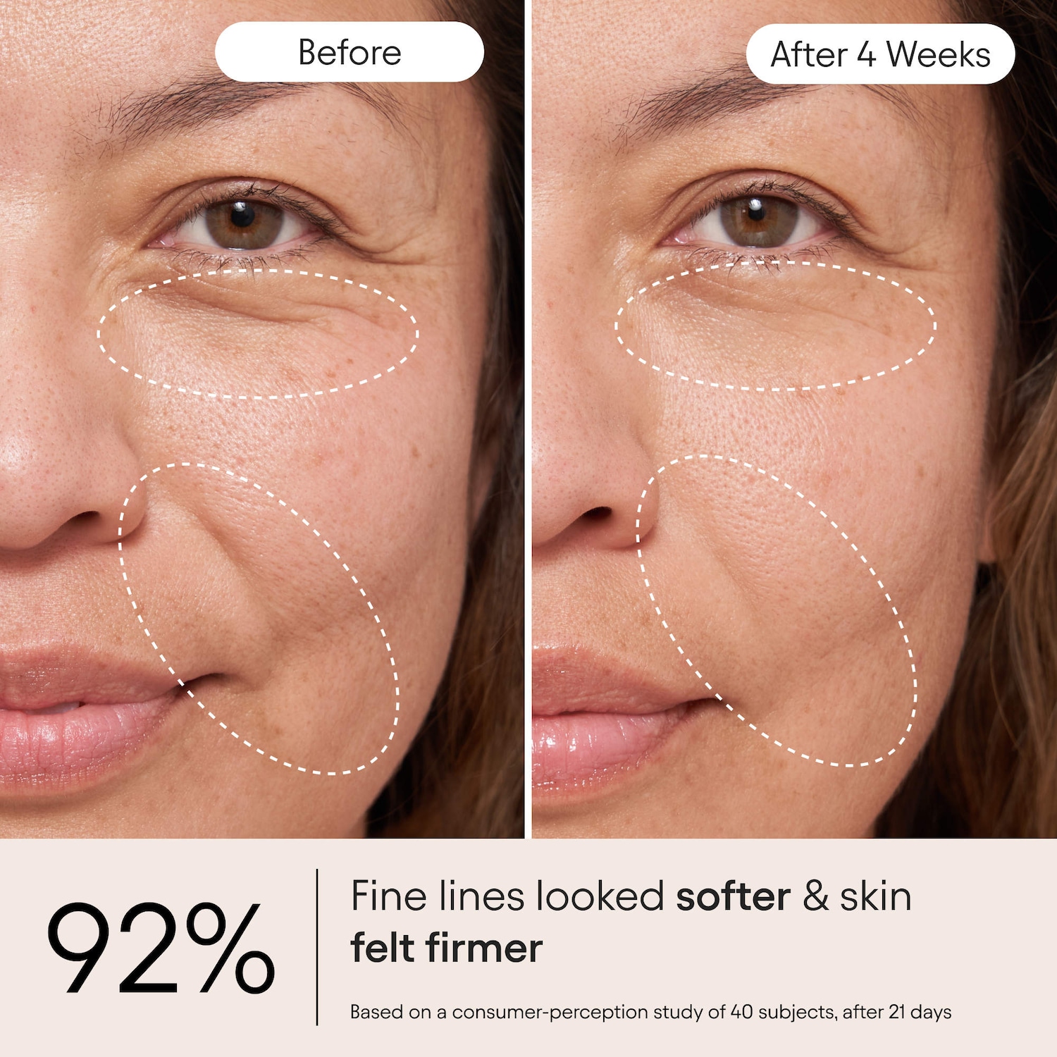 Mini Super Peptide Barrier Repair Moisturizer for Eczema, Wrinkles