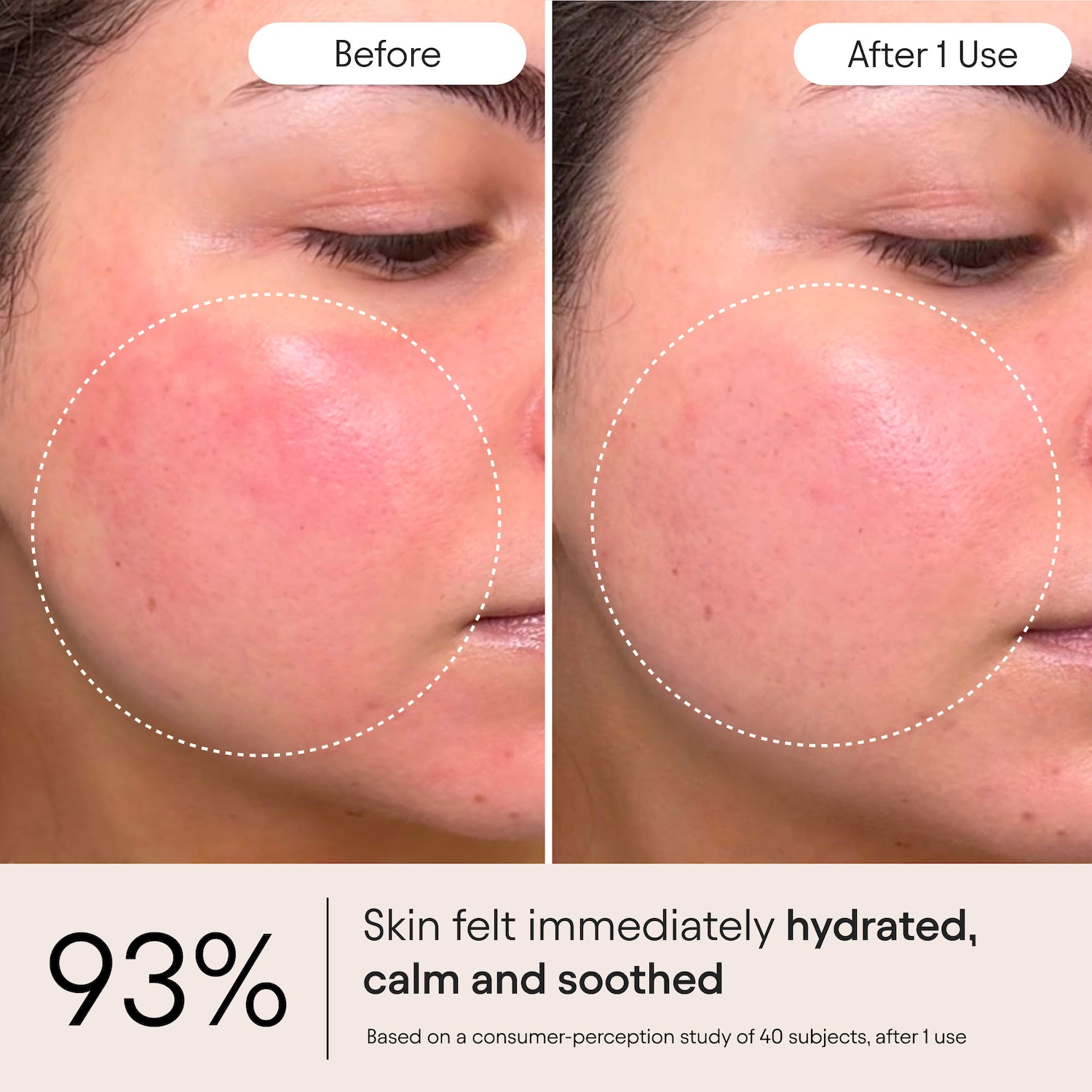 Super Peptide & Ghostberry Moisturizer for Eczema, Barrier and Wrinkle Repair