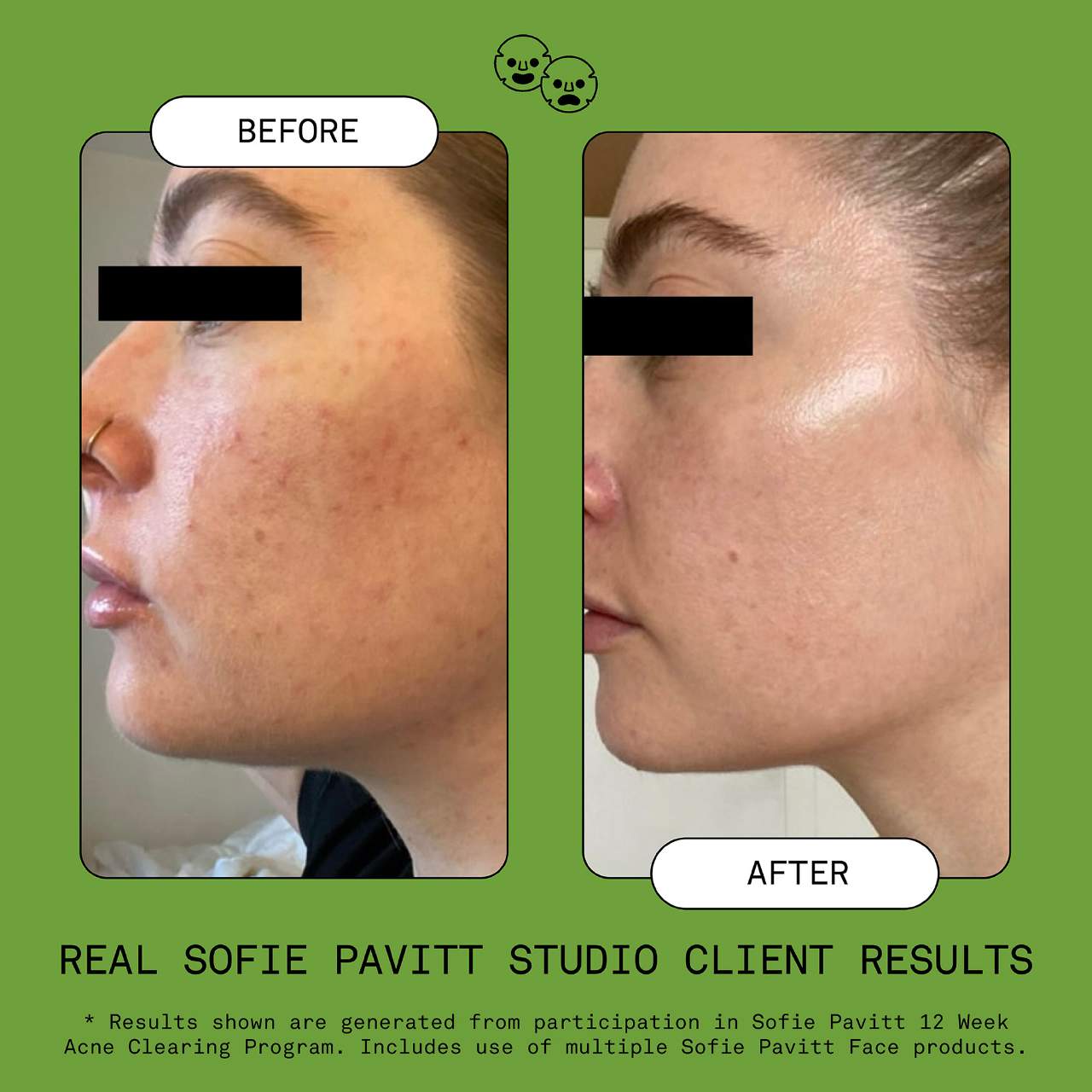 Мягкая гелевая пенка для умывания Sofie Pavitt Face Clean Clean — фото 5