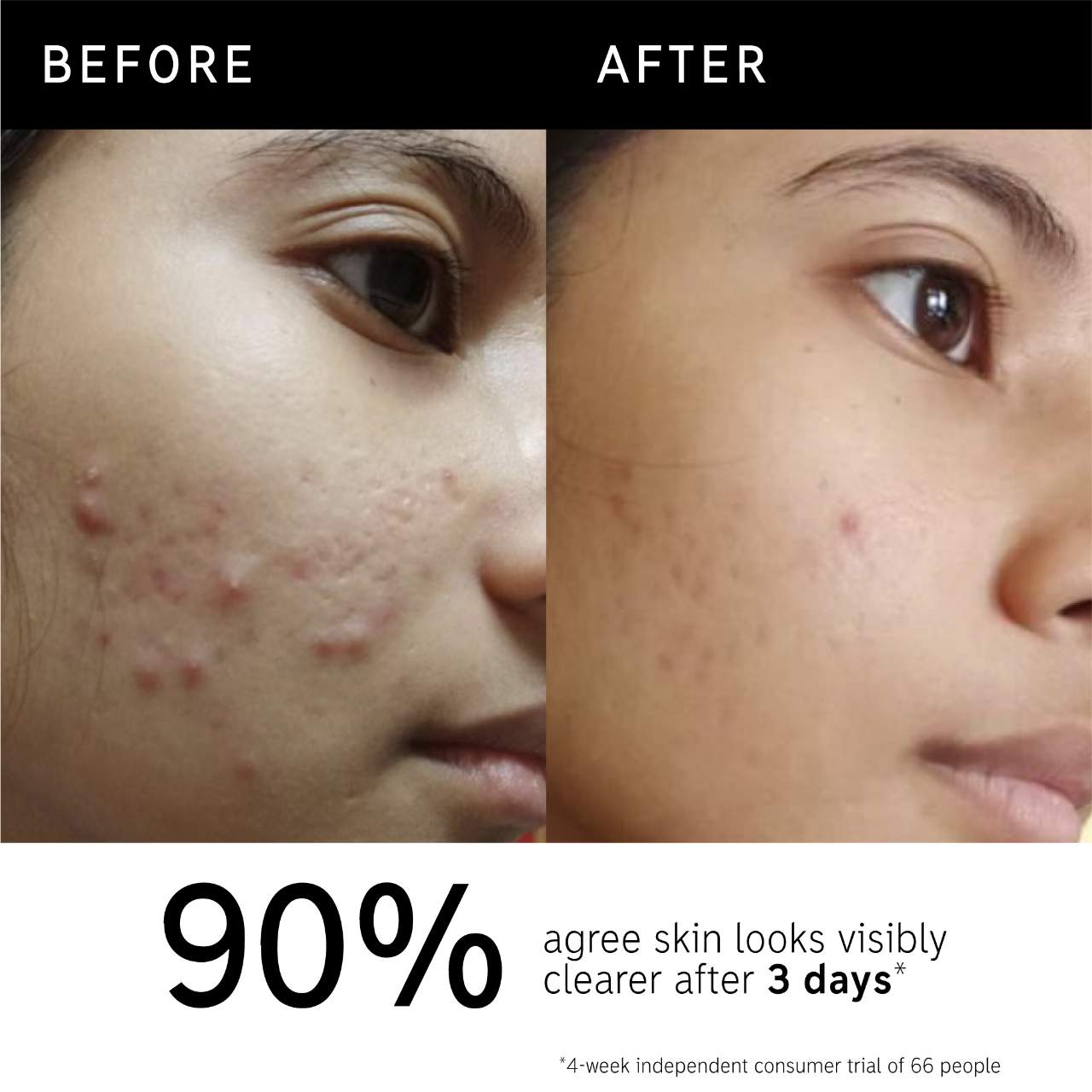 Набор The Inkey List Clearer Skin Starts Here — фото 5