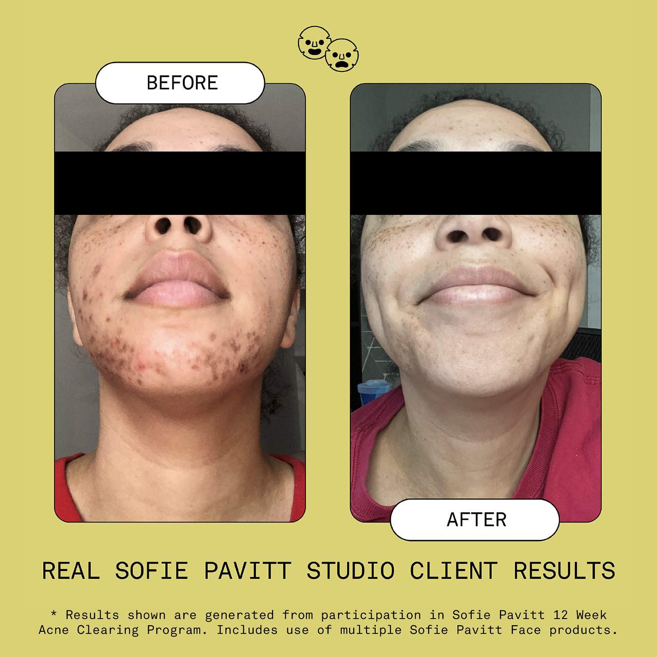 Отшелушивающая очищающая сыворотка с миндальной кислотой Sofie Pavitt Face — фото 7