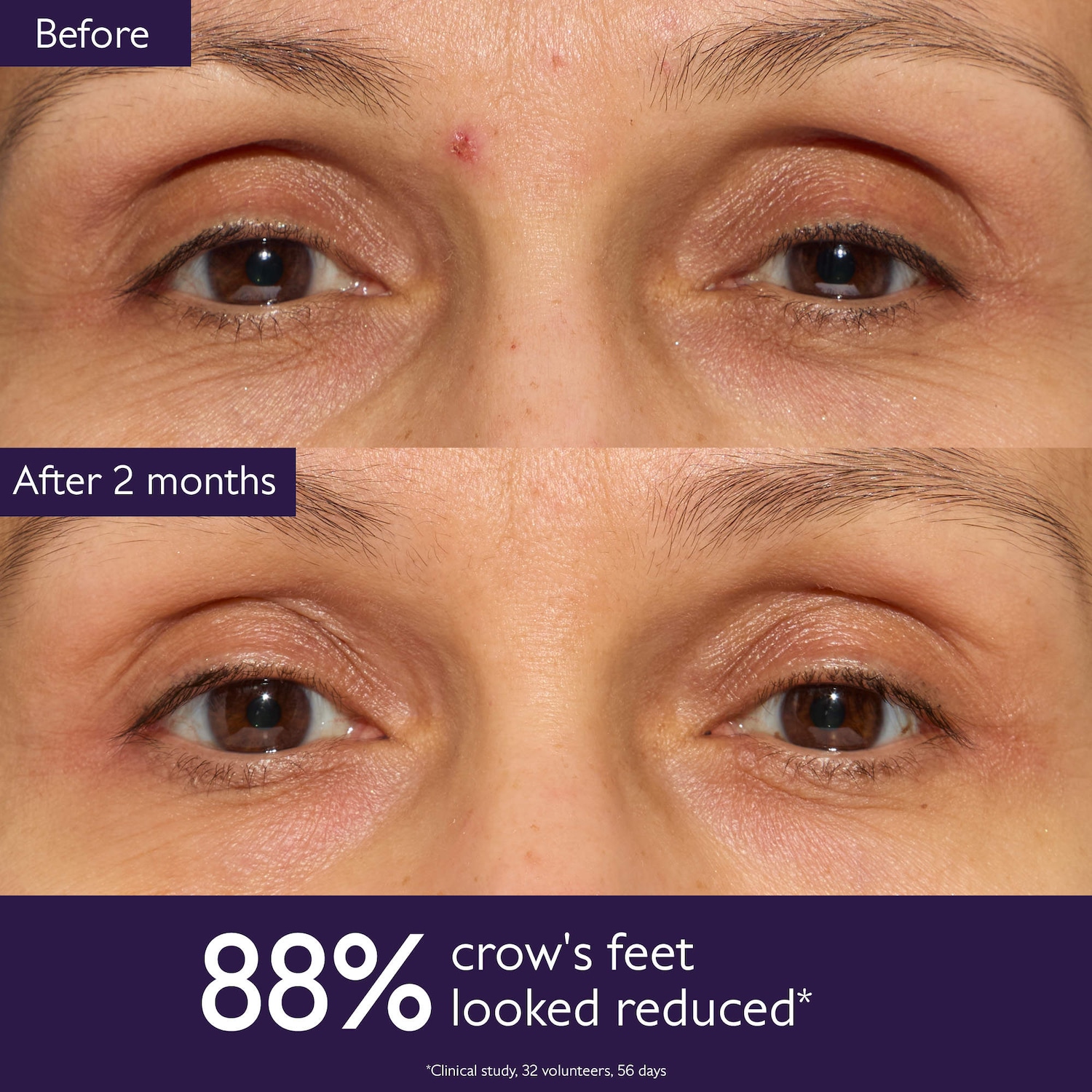 Premier Cru Anti-Aging Eye Cream for Fine Lines and Wrinkles