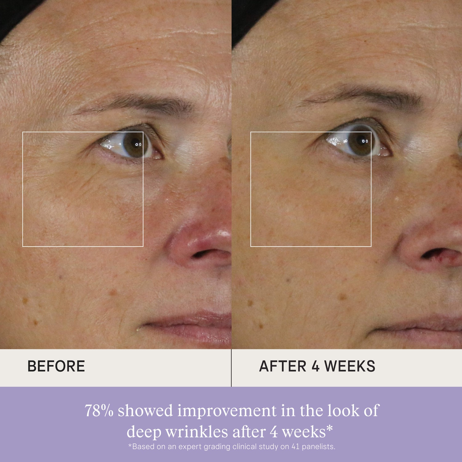 The Silk Serum Wrinkle-Smoothing Retinol Alternative