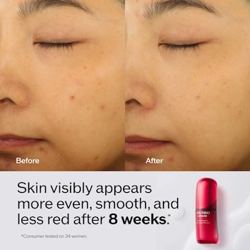 shiseido glutathione Amazon.com: Shiseido RevitalEssence Skin Glow Foundation SPF 30, 140  Porcelain - Buildable, Medium Coverage - 24-HR Hydration & 12-HR Wear -  Transfer, Crease & Fade Resistant - Non-Comedogenic main image 0