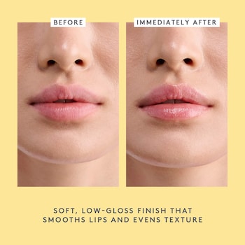 what do you feel inject l-carnitine Love seeing results 🤩 Before & After main image 0