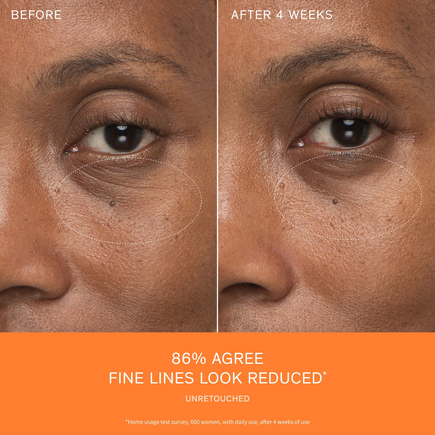 First Care Activating Serum for Anti-Aging