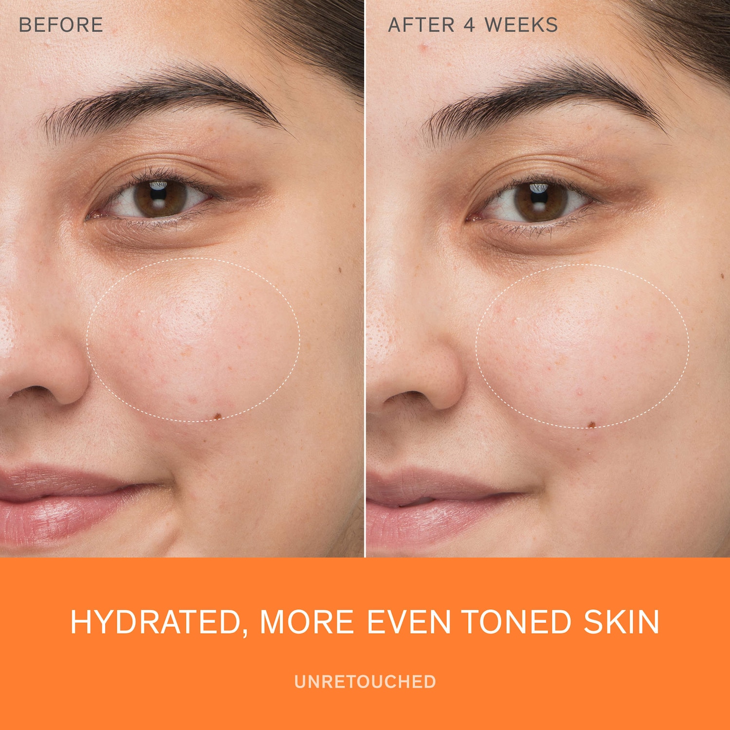First Care Activating Serum for Anti-Aging