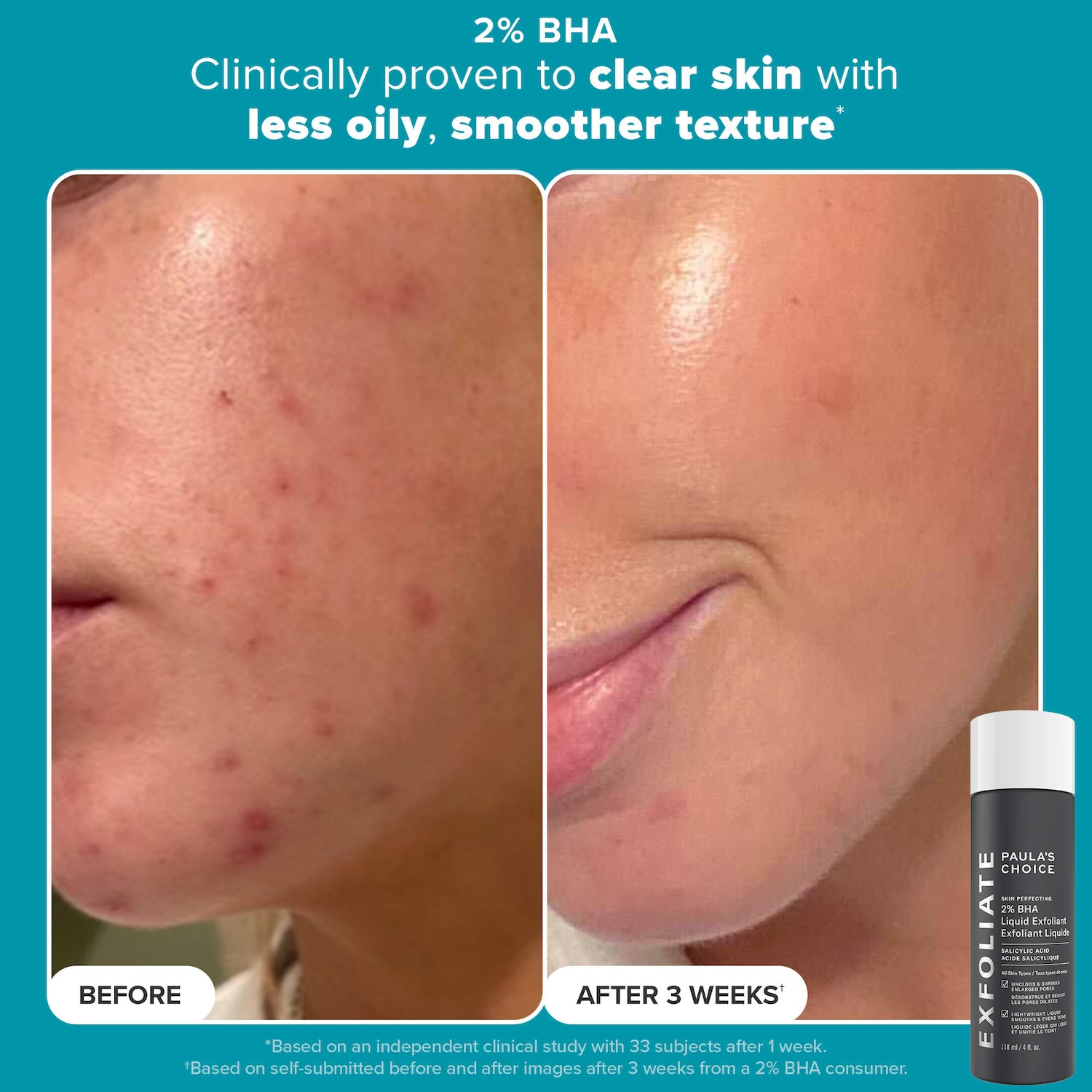 Smooth & Glow Gift Set for clearer, brighter skin - Paula's Choice