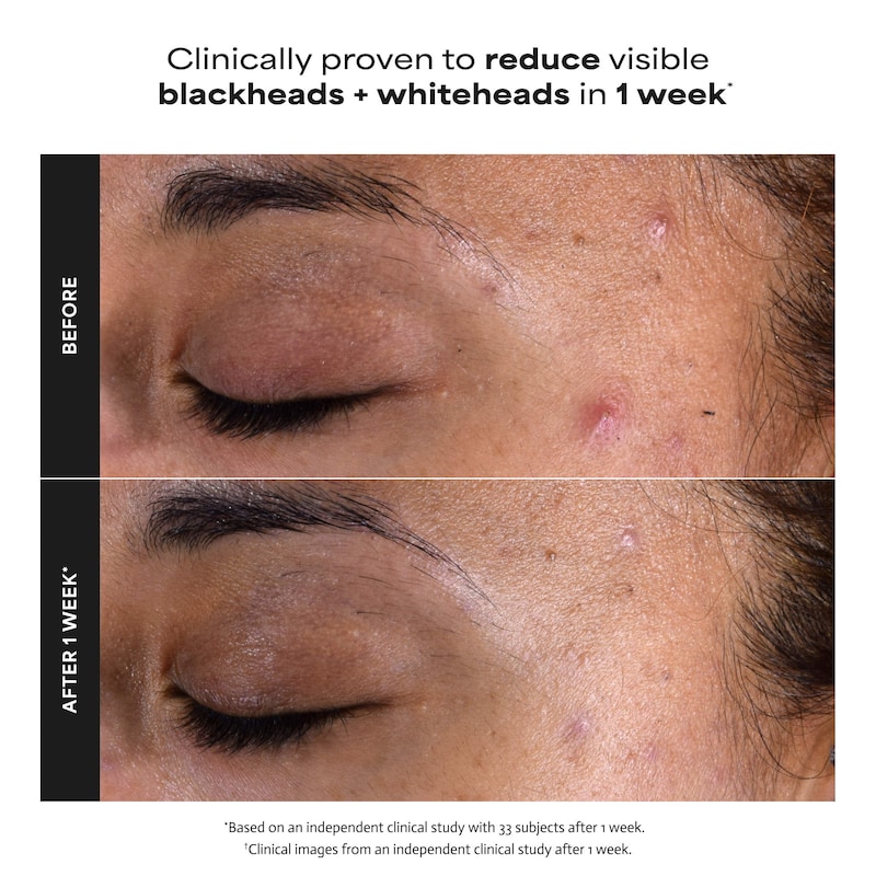 Skin Perfecting 2% BHA Exfoliating Toner Pads for Clear Skin thumbnail 4