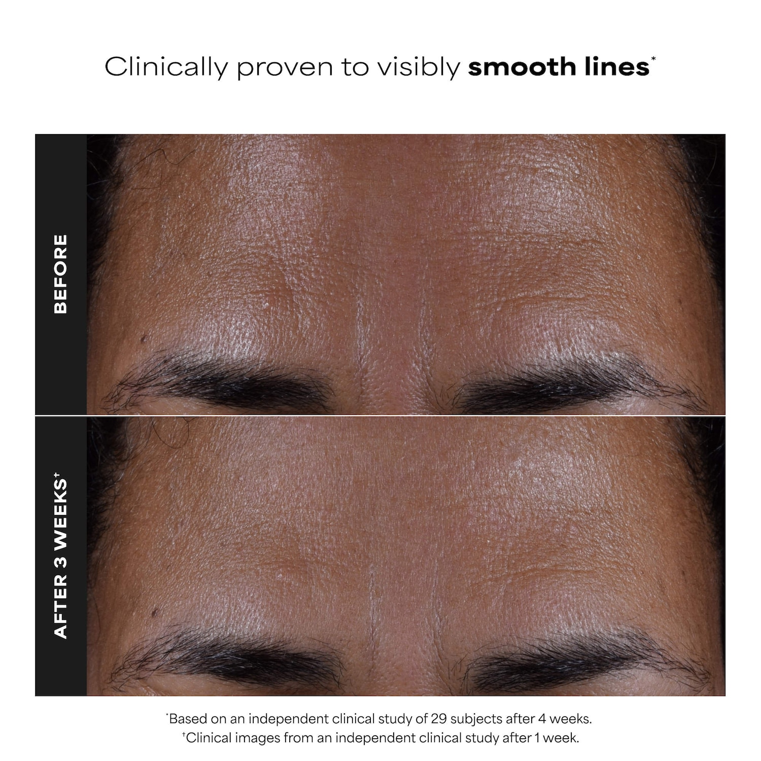 Skin Perfecting 2% BHA Exfoliating Toner for Clear