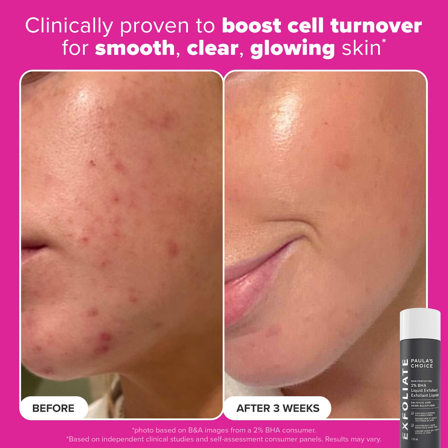Plump & Glow 3-Step Kit for Clear, Firm Skin - Paula's Choice