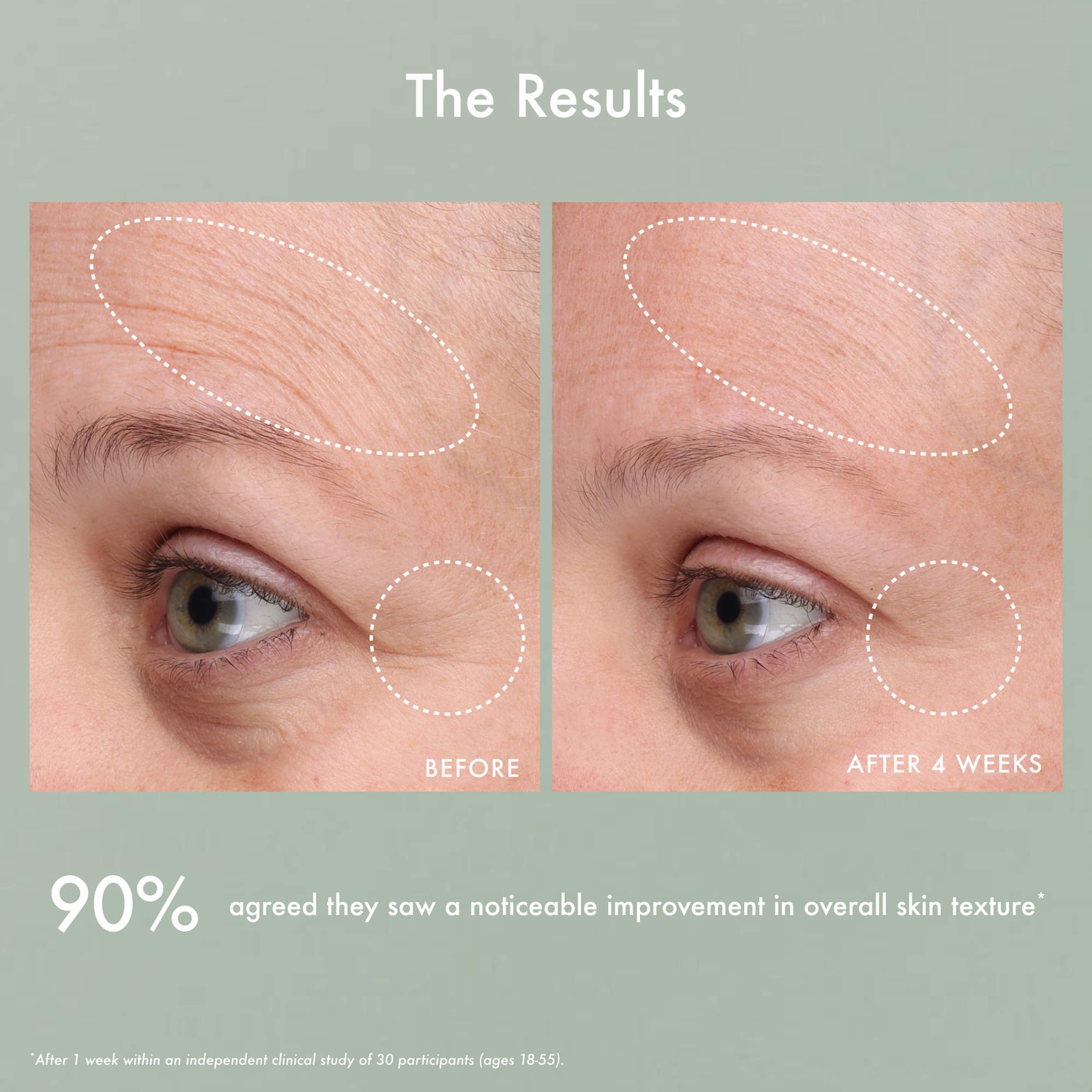 Gentle Reset Daily Exfoliating Pads to Smooth + Minimize Pores