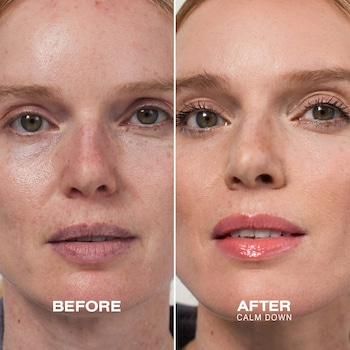 where to inject melanotan A tan without the sun may sound tempting but it's important to understand  how these injectable tanning peptides actually work. Melanotan stimulates  melanocytes, the cells that produce melanin, leading to darker skin