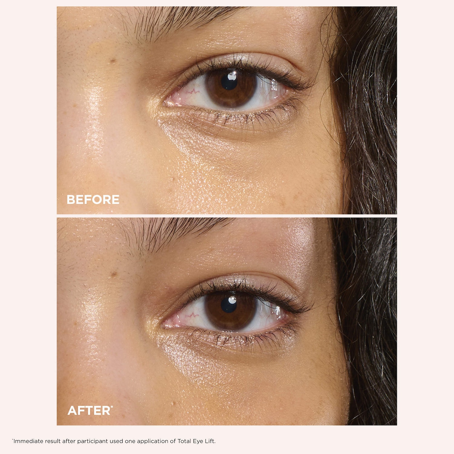 アイケア CLARINS Total Eye Lift 15ml Total Eye Lift: Firming Under-Eye Cream for Wrinkles | CLARINS®