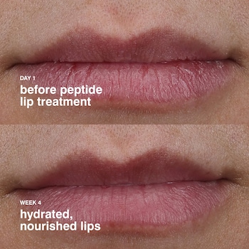 lip 38 c lip treatment review Peptide Nourishing Glaze - rhode Lipid metabolism reprogramming in