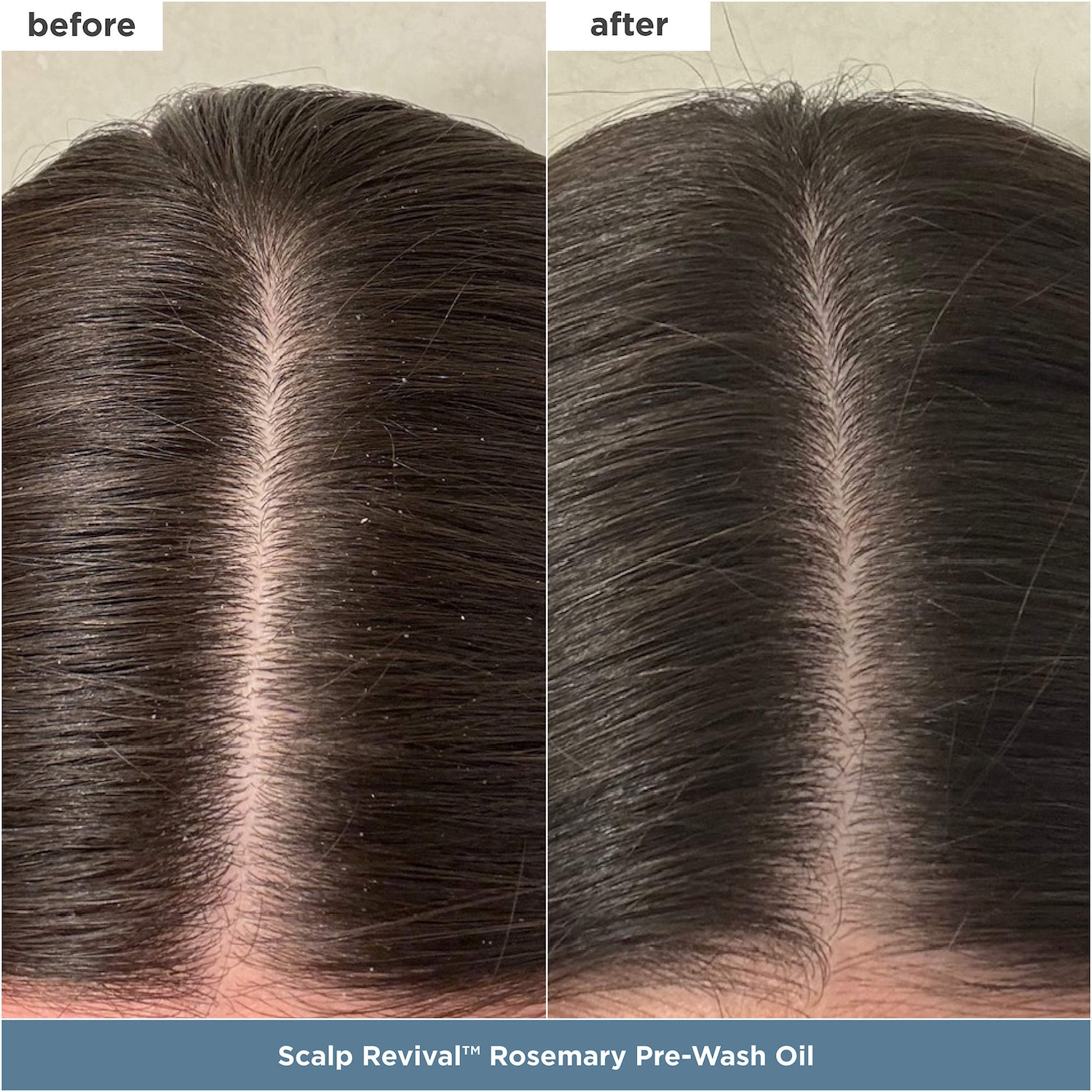 Healthy Hair Delights Gift Set for Scalp-to-Strand Care - Briogeo