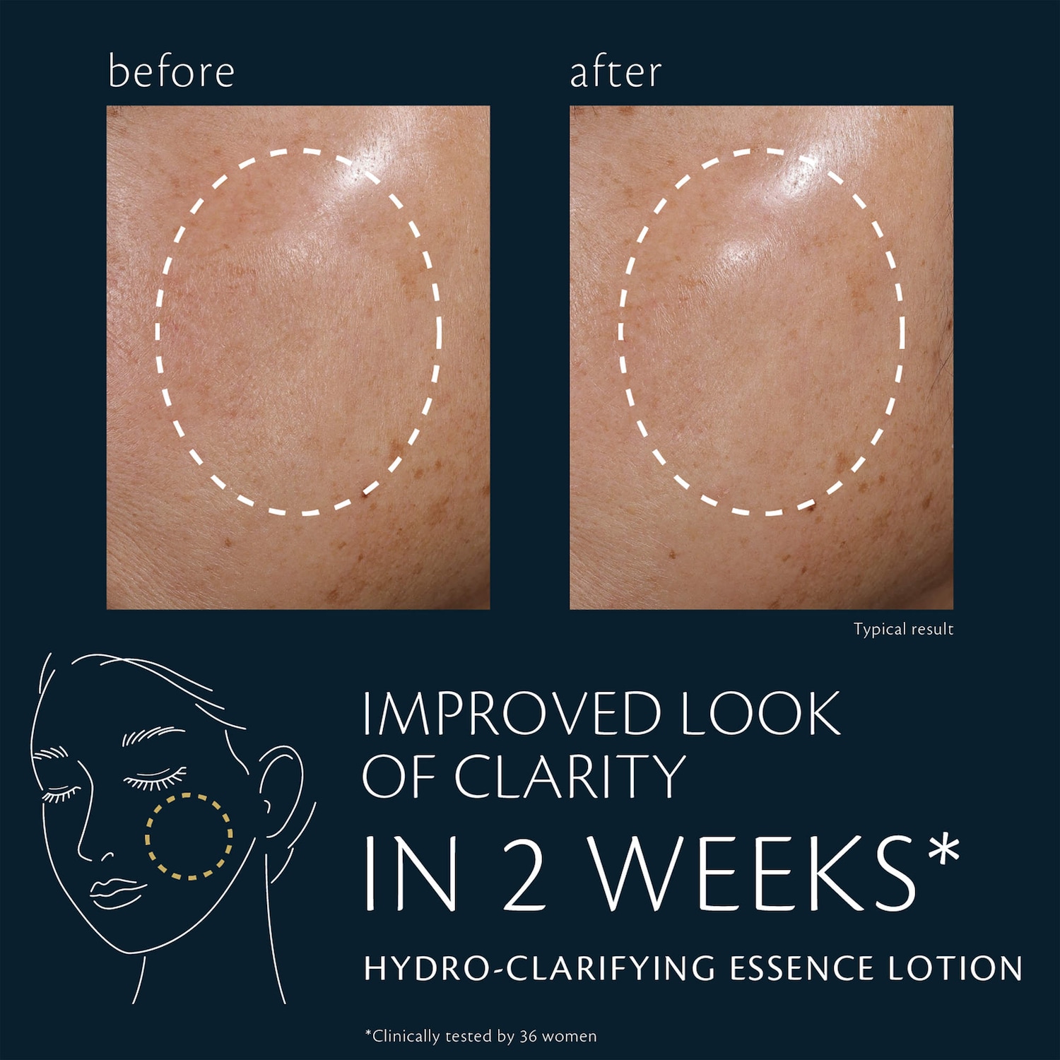 Hydro-Clarifying Essence Lotion - Clé de Peau Beauté