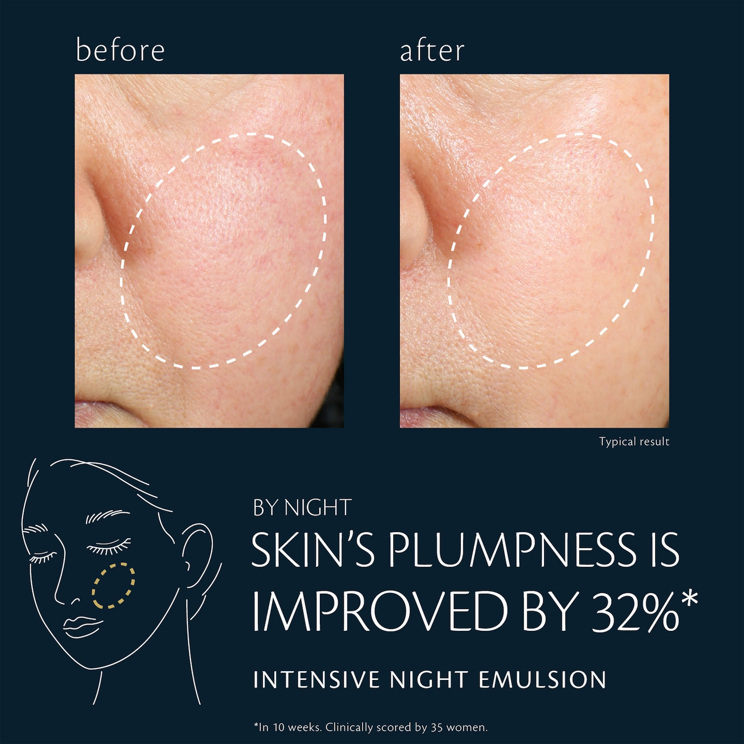 Intensive Night Emulsion - Clé de Peau Beauté | Sephora