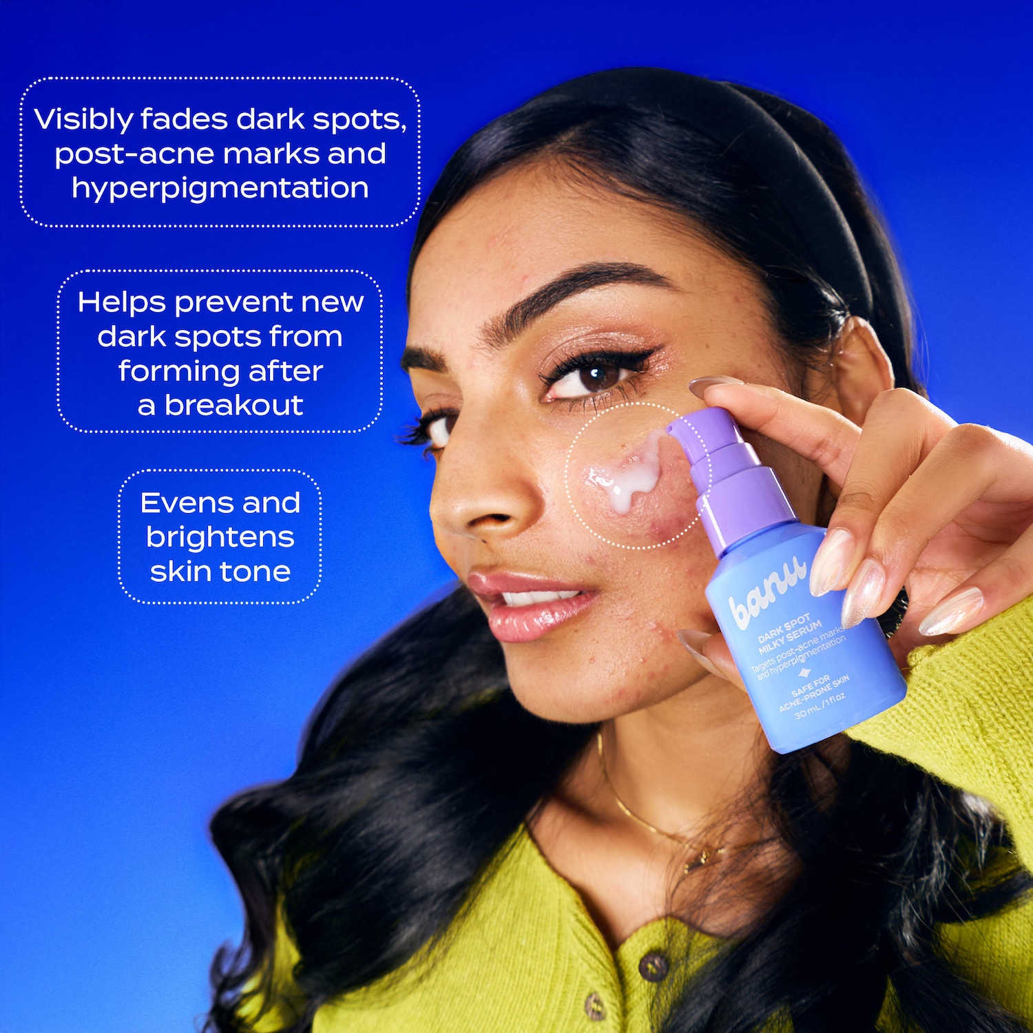 Dark Spot Milky Serum for Brightening, Post-Acne Marks, and