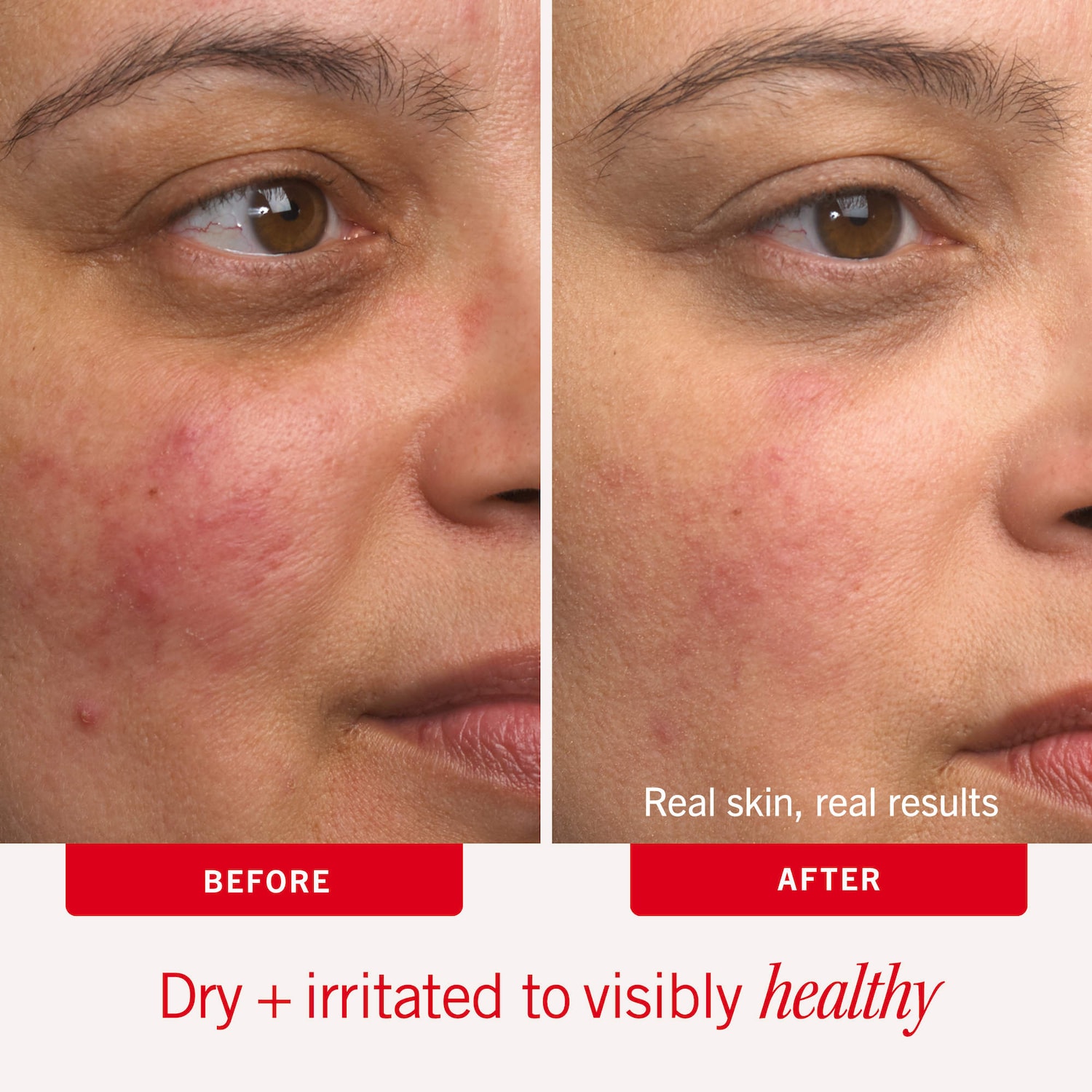 Ultra Repair® Cream Intense Hydration - First Aid Beauty