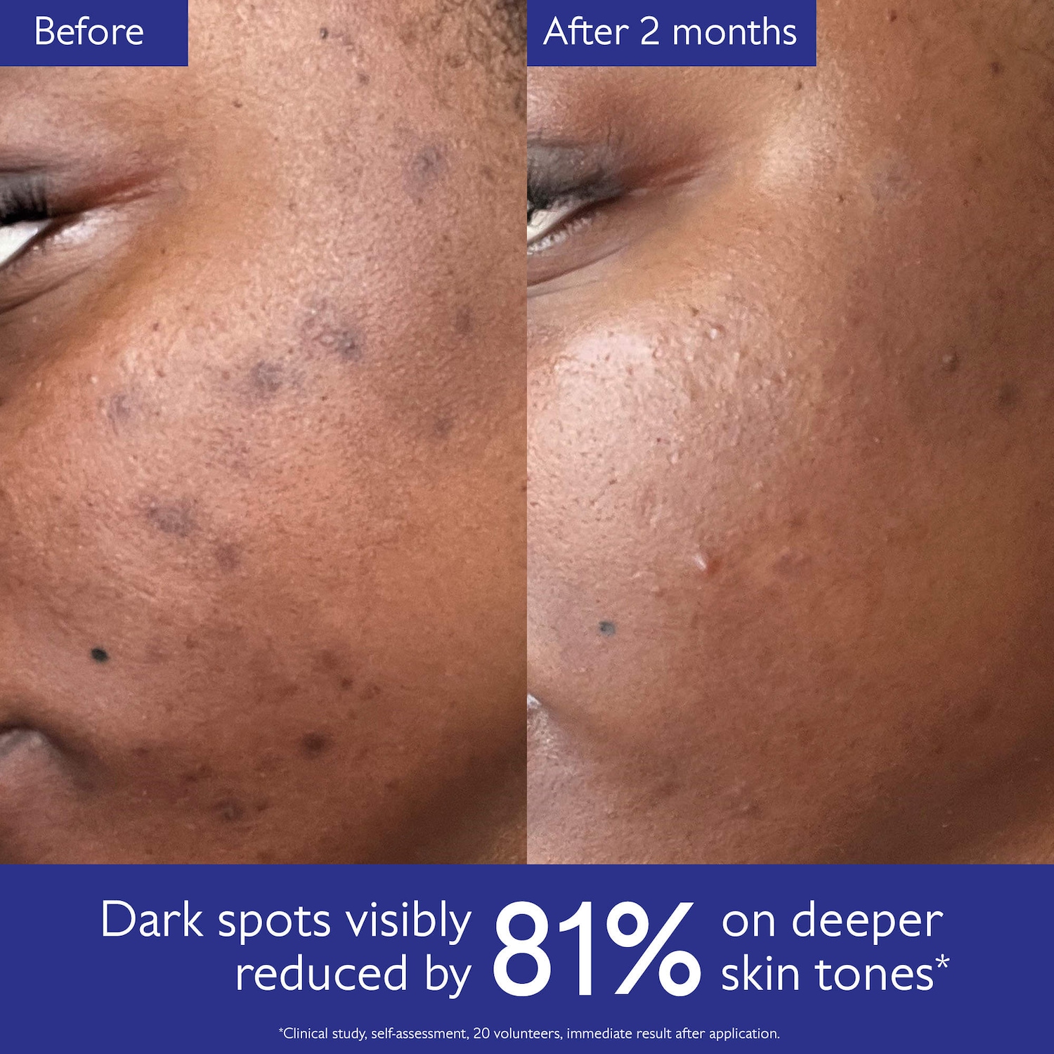 Vinoperfect Brightening Set for Dark Spots and Uneven Skin Tone