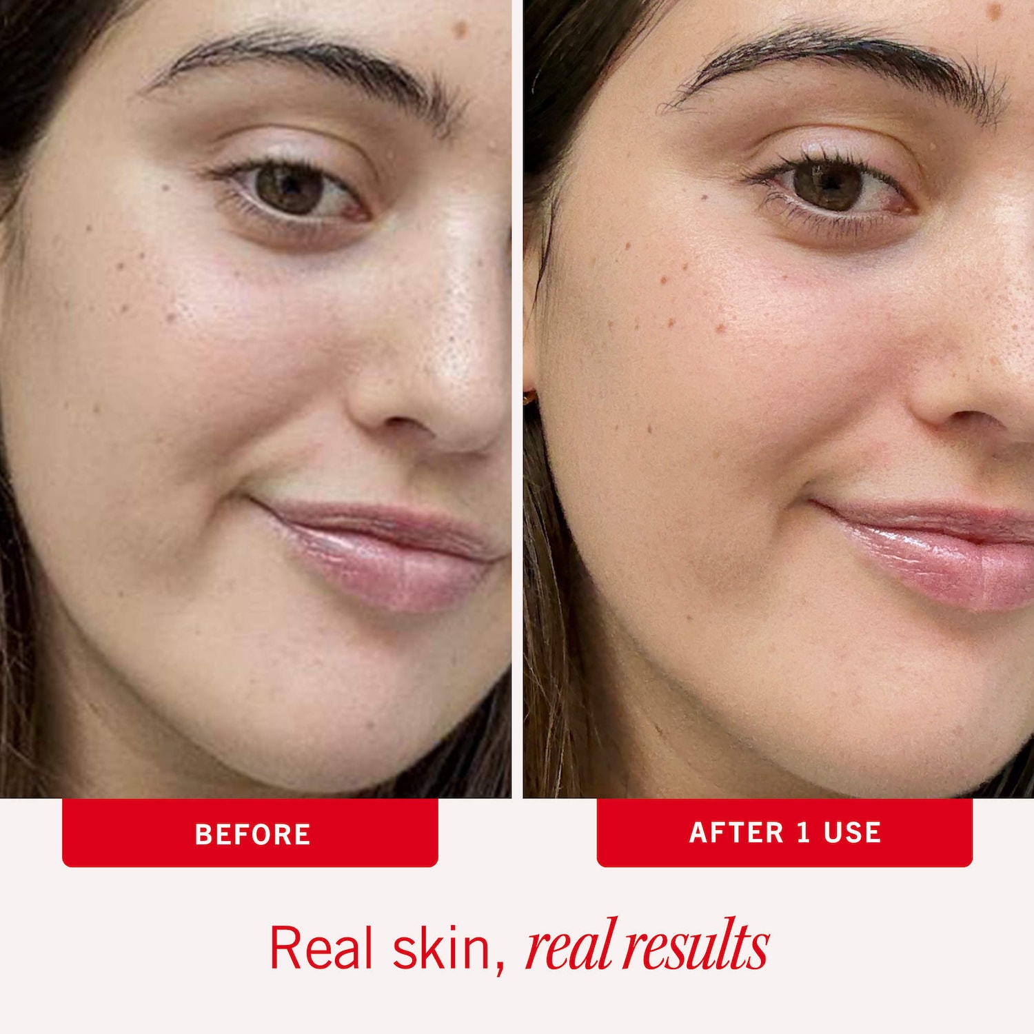 First Aid Beauty Repair Face Lotion - Thumbnail 3