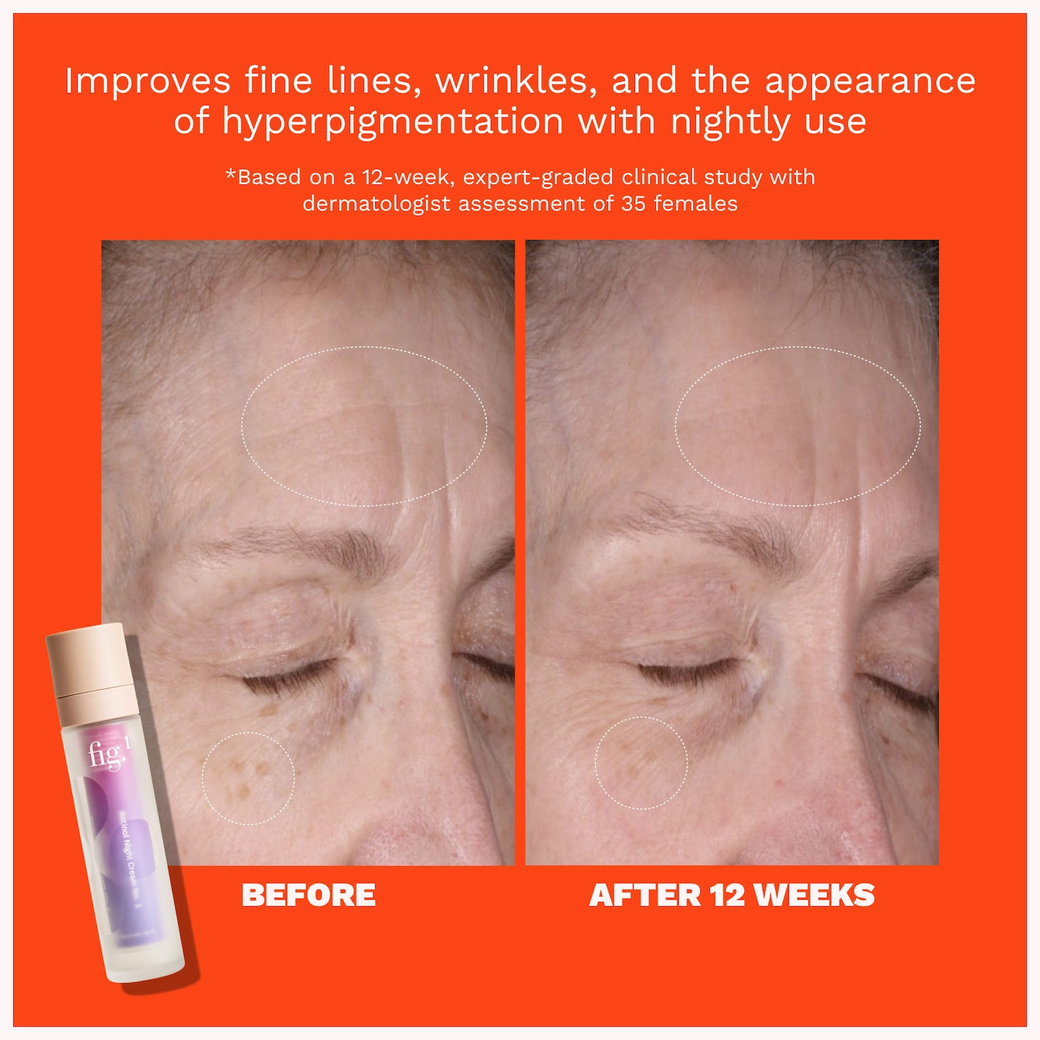 0.6% Retinol Refillable Night Cream for Fine Lines + Wrinkles