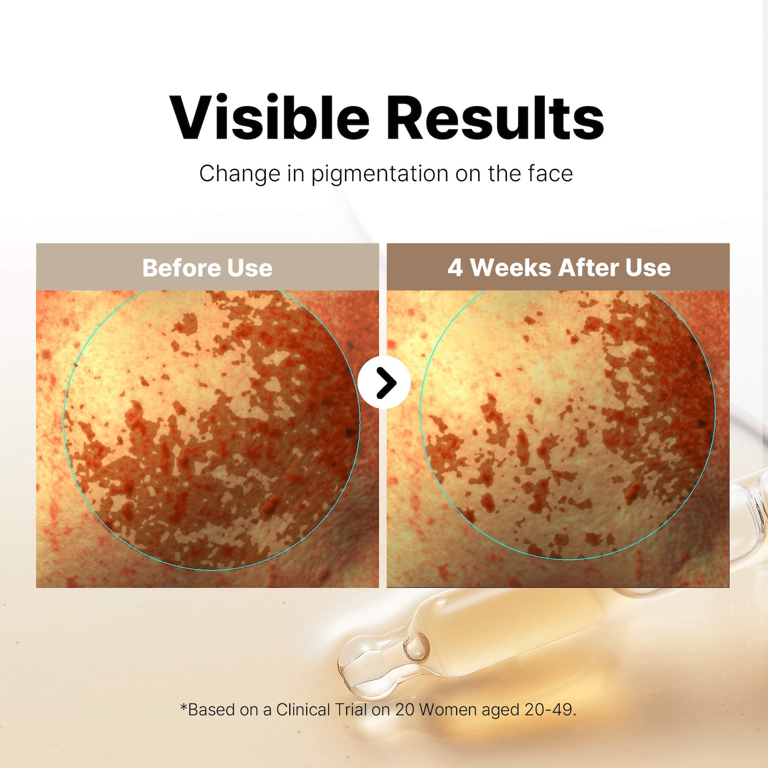 値引き中esthemax DISCOLORATION ALPHA ARBUTIN DISCOLORATION ALPHA ARBUTIN HYDROJELLYÂ®