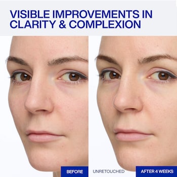 kb glutathione before and after Glutathione Before and After in Los Angeles