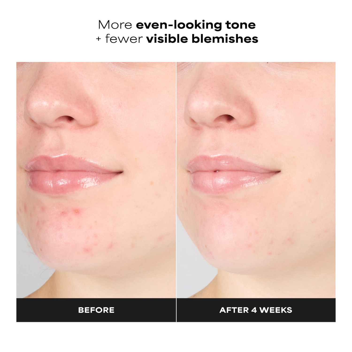 Paula’s Choice Skin Perfecting BHA Exfoliating Toner - Thumbnail 5