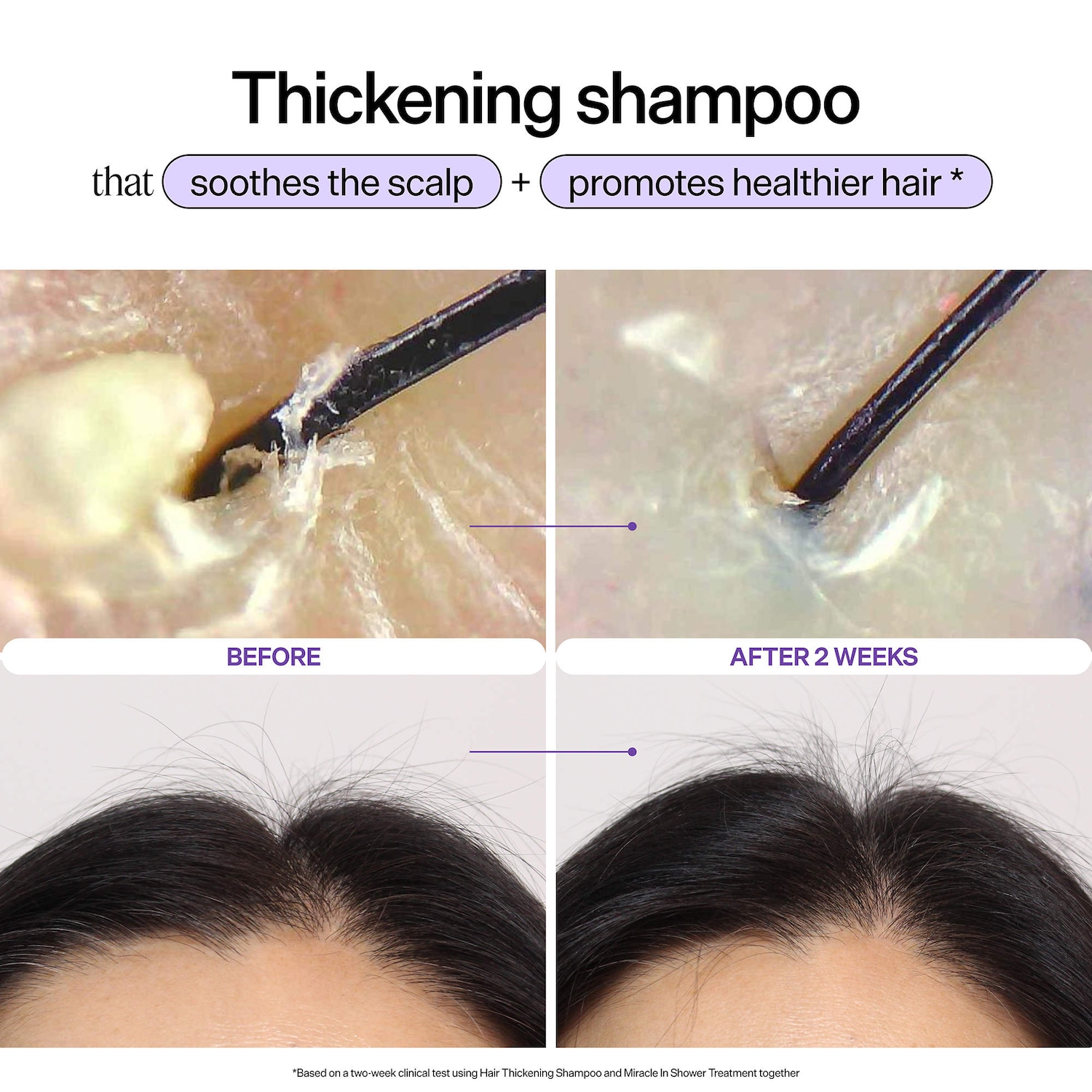 Mini Hair Thickening Shampoo & Miracle In Shower Treatment Gift