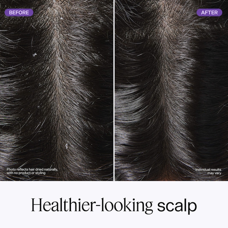 Pre-Shampoo Exfoliating Detox Water for Scalp Build Up thumbnail 3