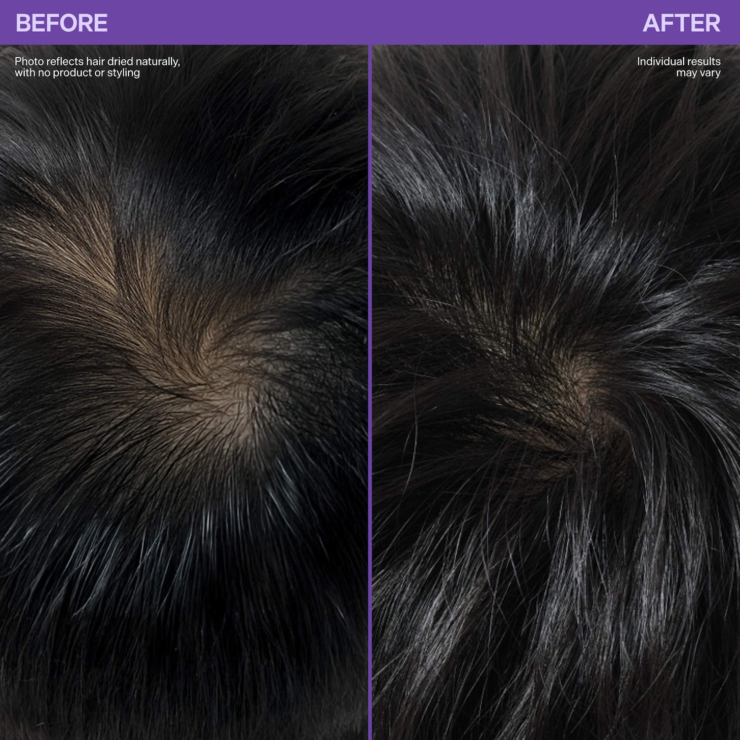 Dr. Groot Hair Thickening Shampoo, Conditioner & Treatment - Thumbnail 4