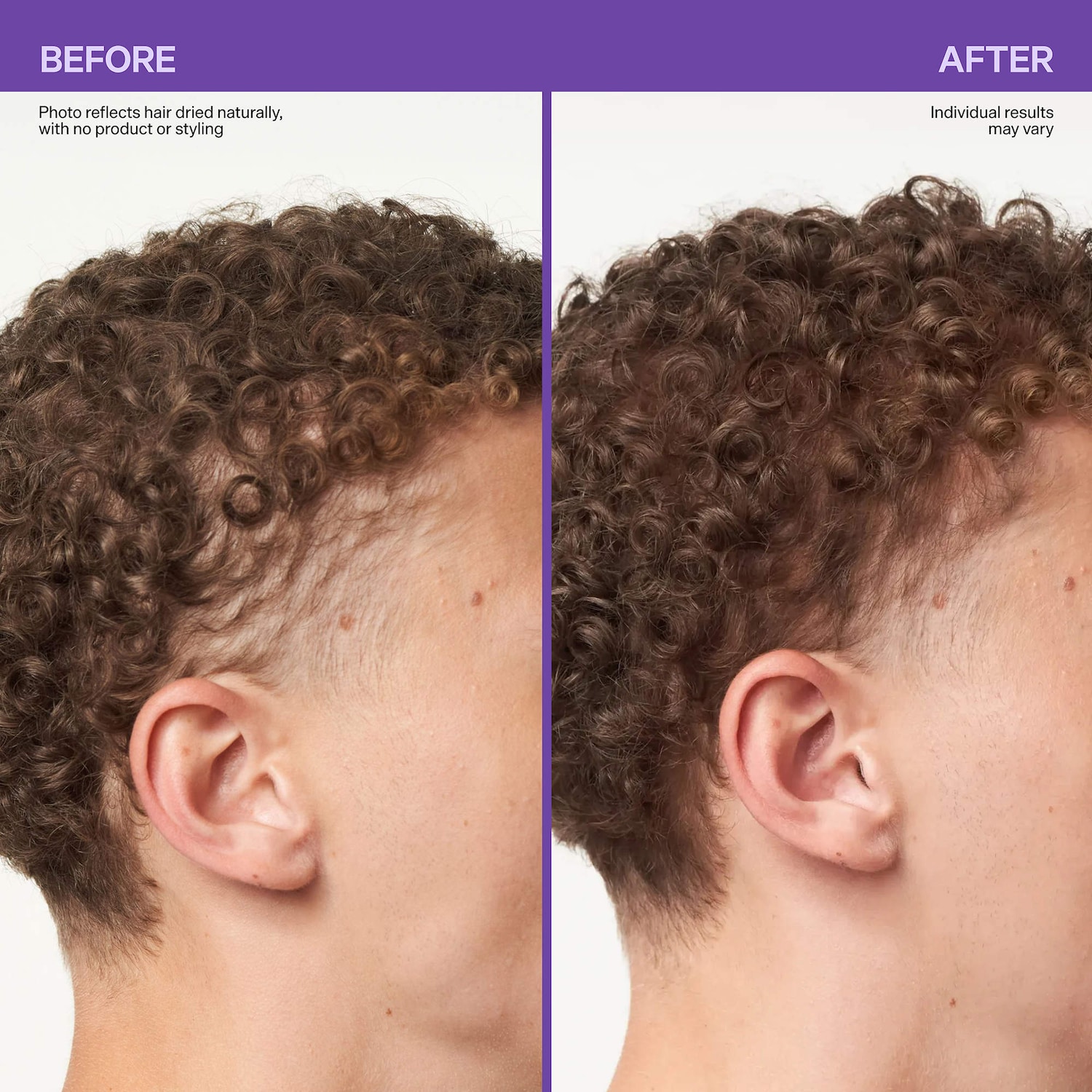 Dr. Groot Scalp & Hair Treatment - Thumbnail 3
