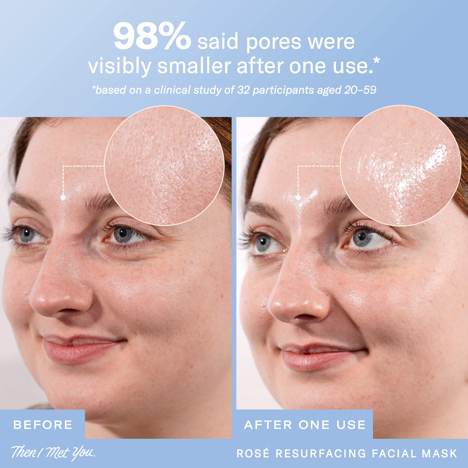 Rosé Resurfacing & Brightening BHA + AHA Facial Mask for Minimized