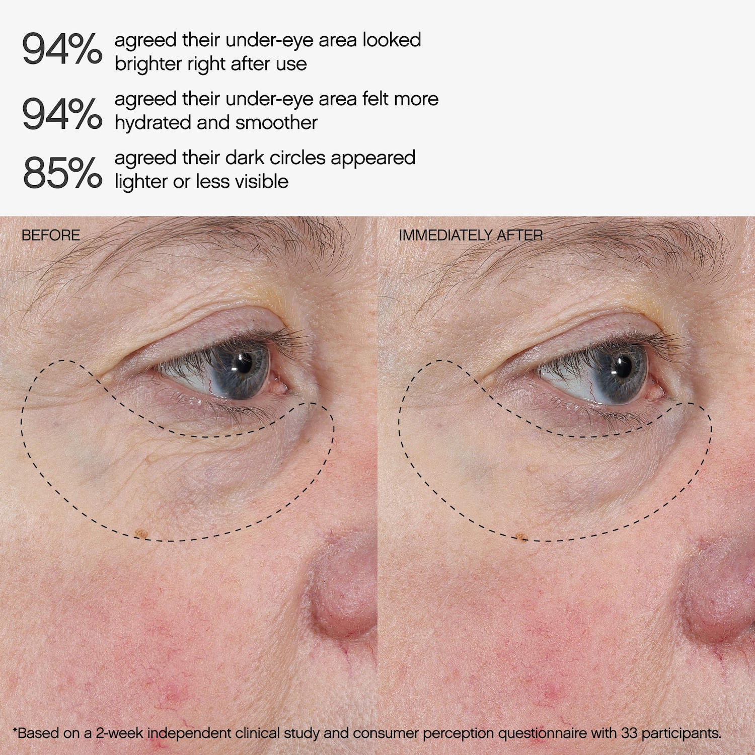 Faded Under Eye Brightening & Clearing Masks