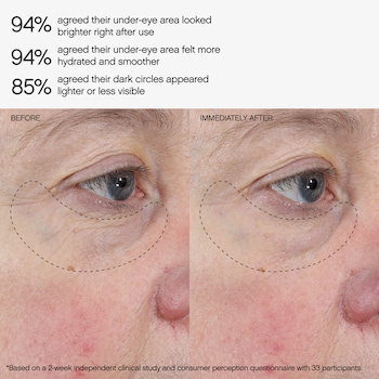 glutathione eye lightening Cream Dark Circles & Fine Lines Faded Under Eye Brightening &
