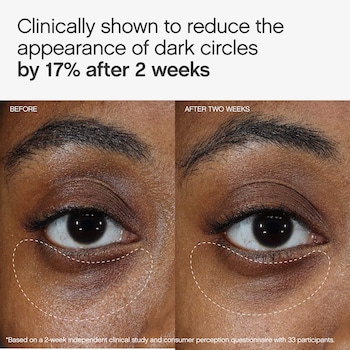 does glutathione remove dark circles Faded Under Eye Brightening & Clearing Eye Masks - Topicals