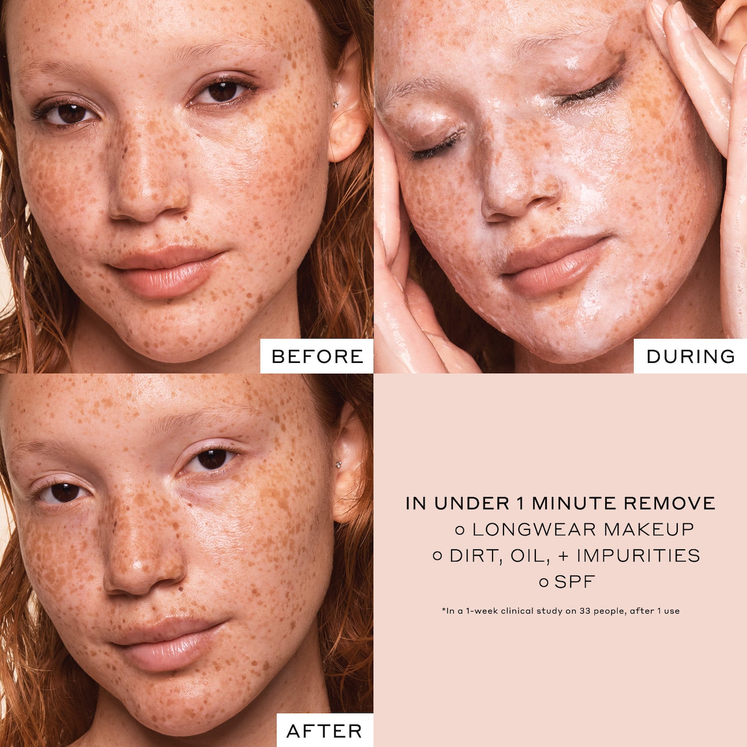Clinical Skin Treats Set - OLEHENRIKSEN | Sephora