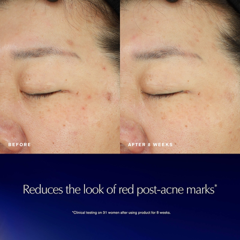 Advanced Night Repair Recovery Treatment Essence/Treatment Lotion With Bio-Exosome thumbnail 3