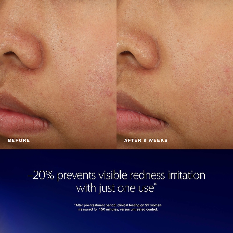 Advanced Night Repair Recovery Treatment Essence/Treatment Lotion With Bio-Exosome thumbnail 4