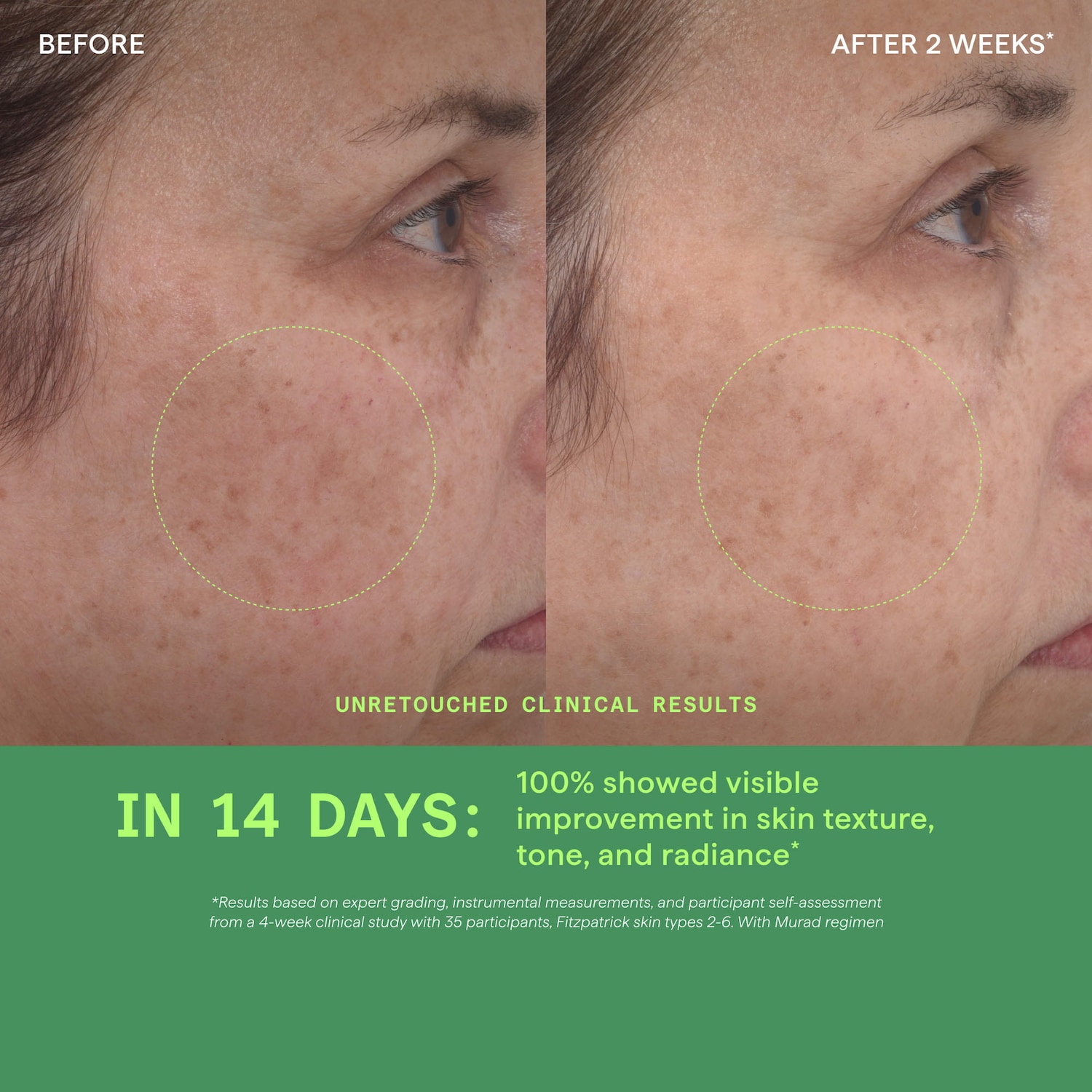 Омолаживающая сыворотка с ретинолом Murad Retinol Youth Renewal — фото 5
