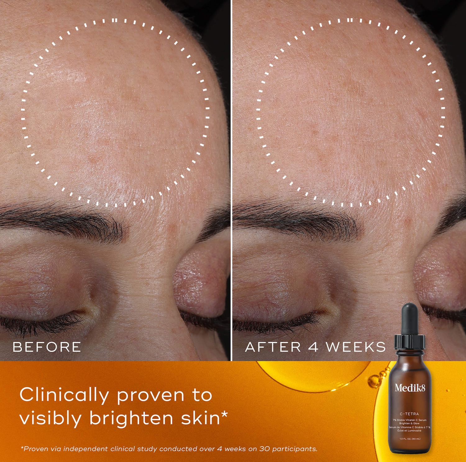 C-Tetra 7% Stabilized Vitamin C Brightening Serum for Sensitive