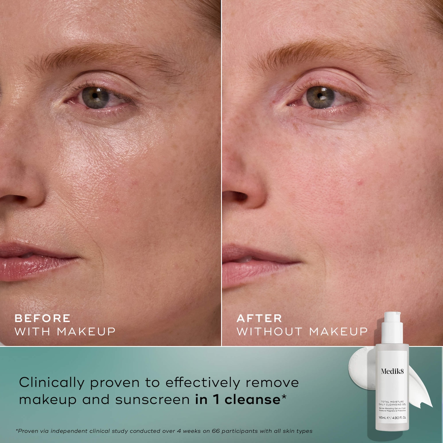 Total Moisture Daily Hydrating Cleansing Gel for Barrier
