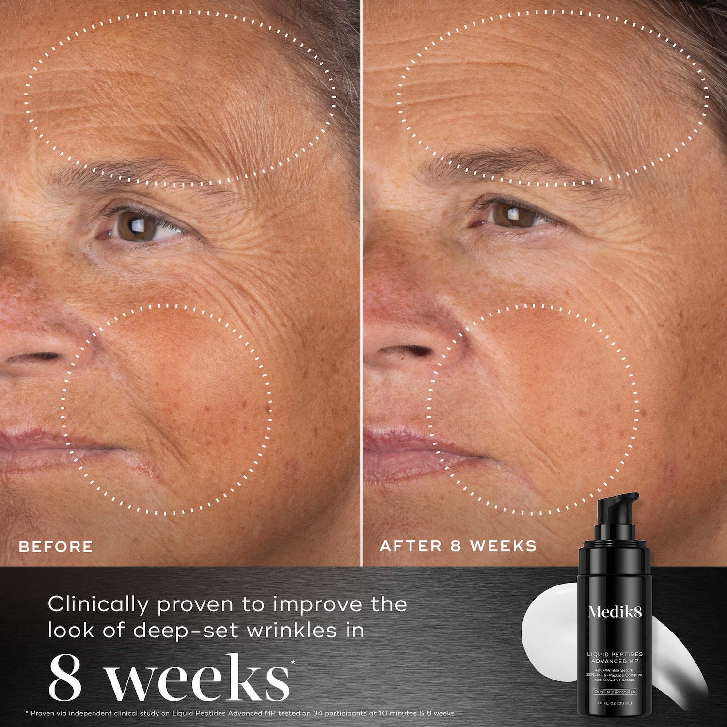 Liquid Peptides Advanced MP Wrinkle Reduction Serum with 13 Age