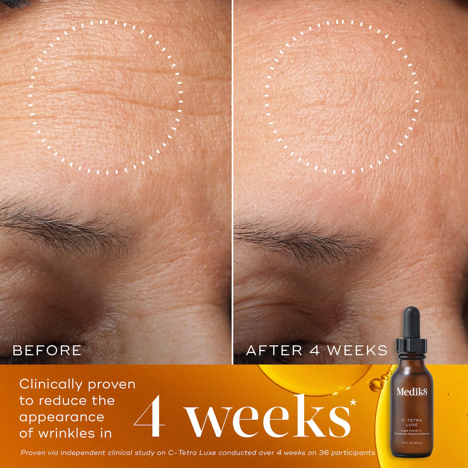 medik8 c tetra lipid vitamin c radiance serum reviews C-Tetra 7% - 30ml Enhanced with soothing centella asiatica to ensure a comfortable application for sensitive skin C-Tetra Luxe 14% Stabilized Vitamin