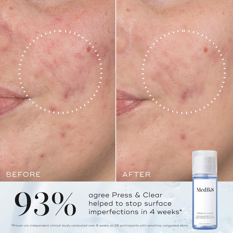 Press & Clear Gentle Exfoliating Salicylic Acid BHA Toner thumbnail 4