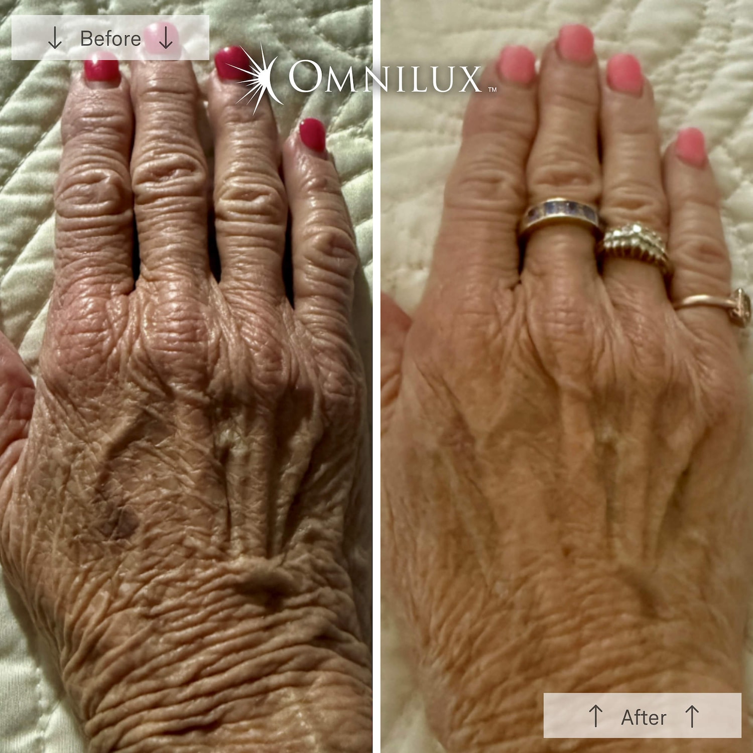 Перчатки Omnilux Contour Glove with Red and Near Infrared Light Therapy LED Device — фото 4